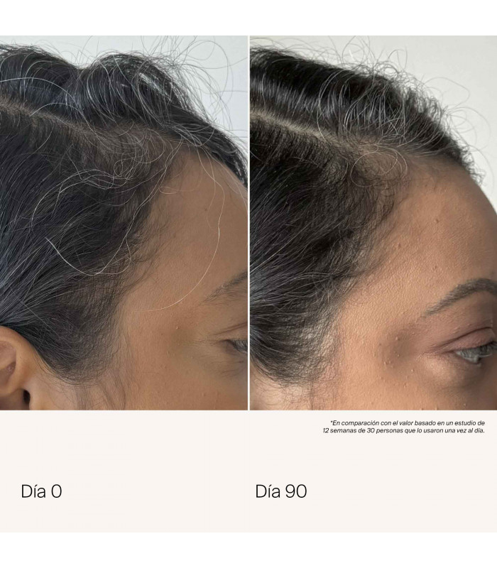 Scalp Care Density Serum